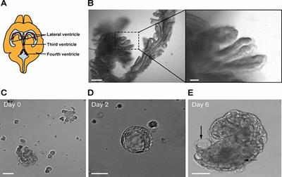 Three-Dimensional Explant Platform for Studies on Choroid Plexus Epithelium